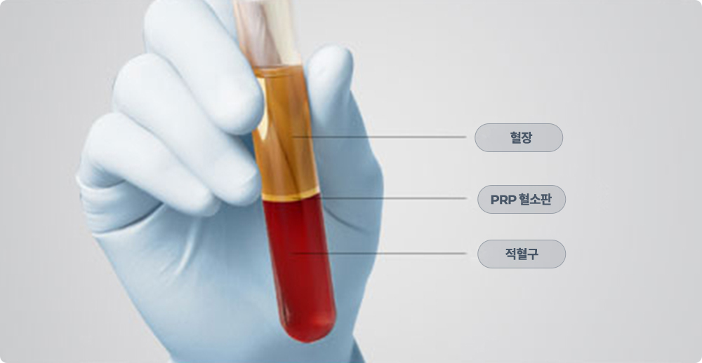 강남서울밝은안과