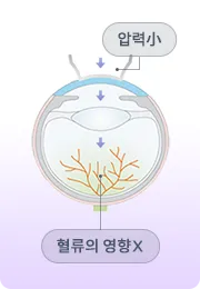 강남서울밝은안과