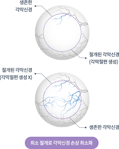 강남서울밝은안과