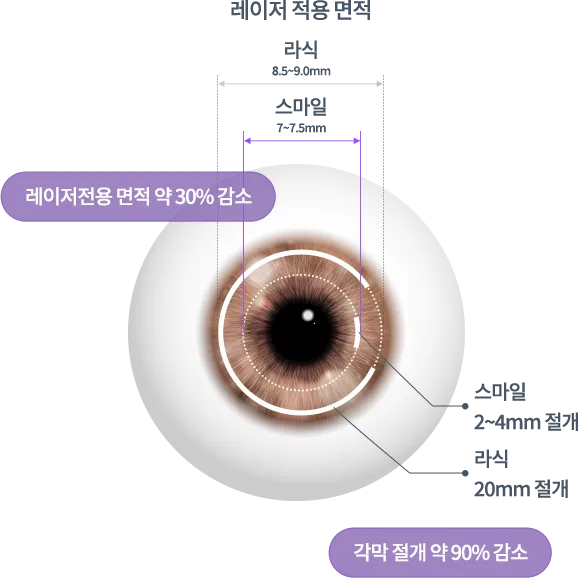 강남서울밝은안과