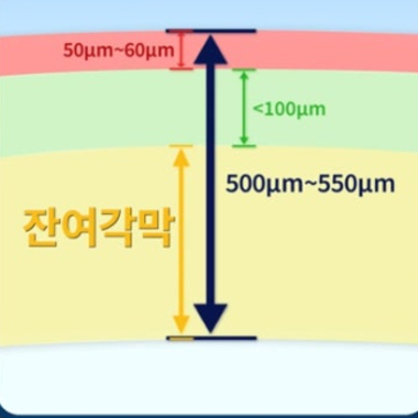 강남서울밝은안과