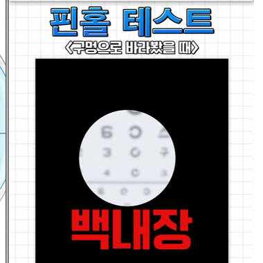 강남서울밝은안과