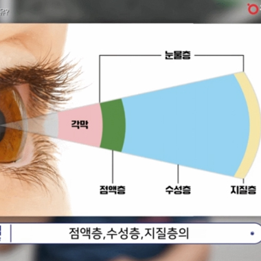 강남서울밝은안과