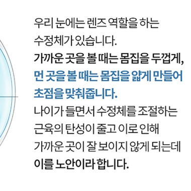 강남서울밝은안과