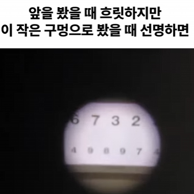 강남서울밝은안과